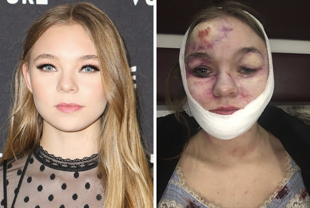Ghostland | Após ter rosto desfigurado durante as gravações, atriz entra com processo judicial